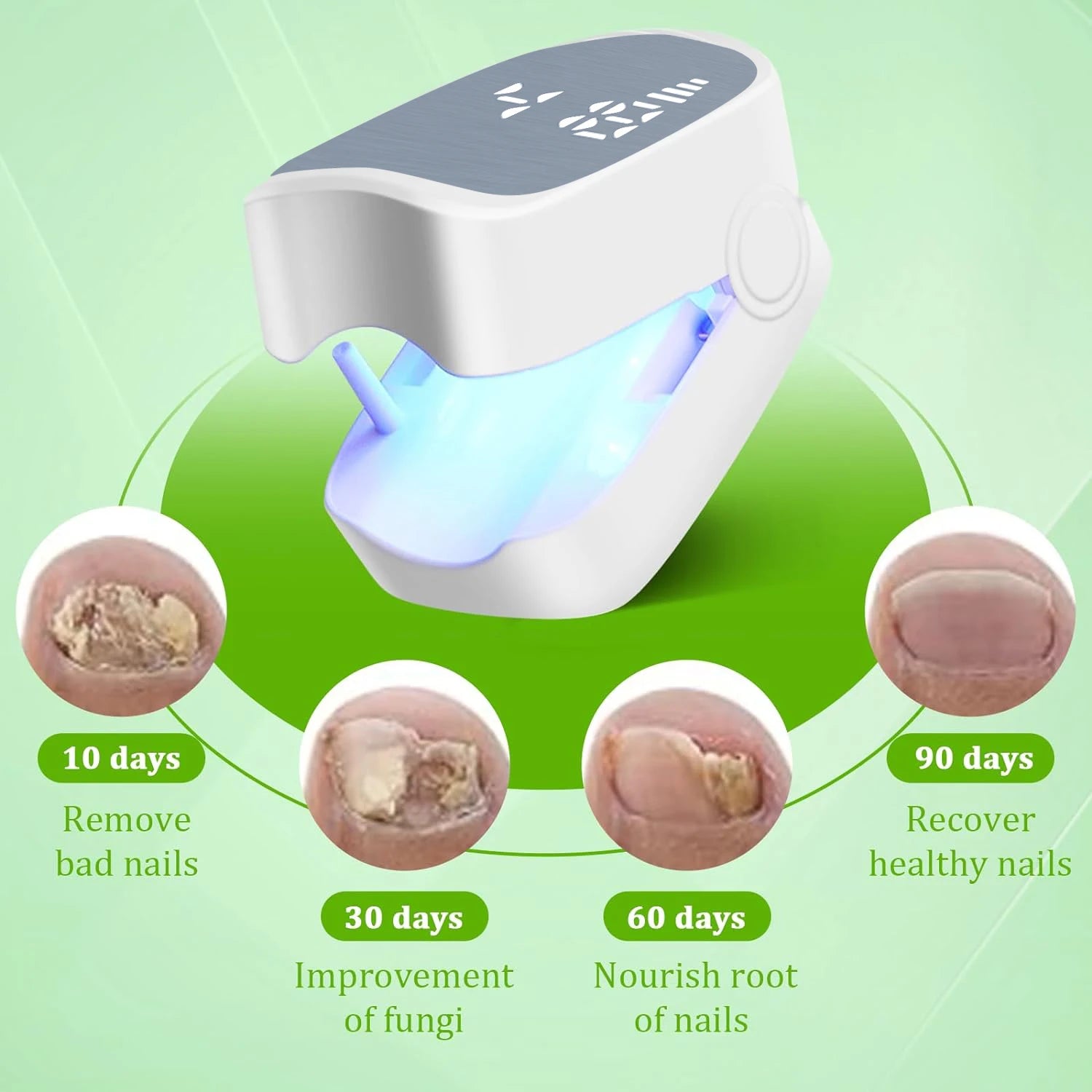 Nail Fungus Treatment LED Laser Device for Cleaning Onychomycosis USB Charge 905Nm Infrared Light 470Nm Blue Light Nail Salon