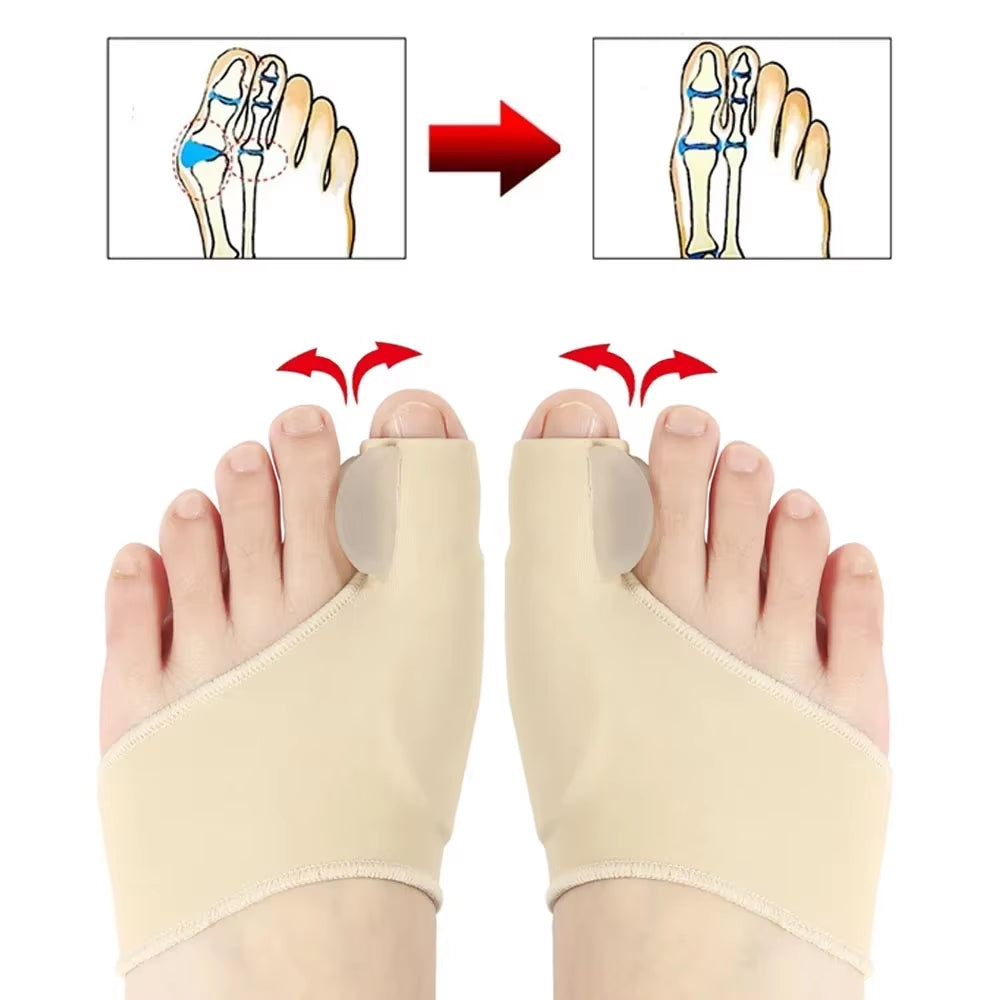 Bunion Corrector and Toe Separator for Hallux Valgus Relief and Big Toe Support Solutions