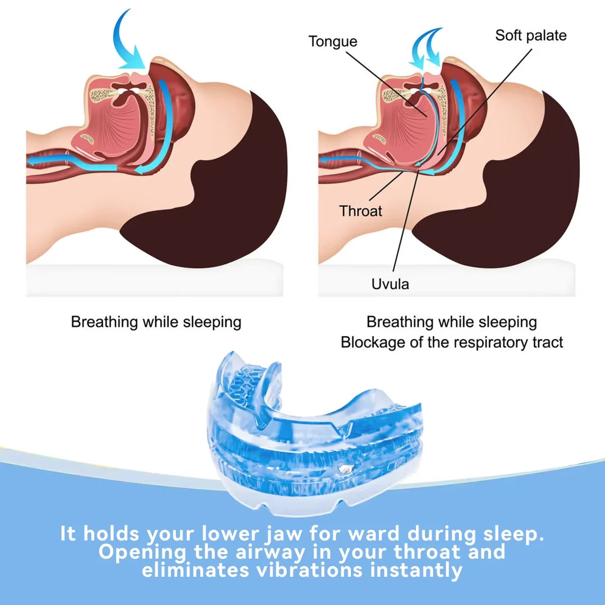 Adjustable Anti-Snoring Mouthguard and Bruxism Relief for Enhanced Sleep Quality