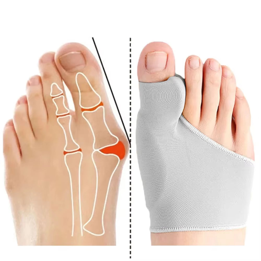Bunion Corrector and Toe Separator for Hallux Valgus Relief and Big Toe Support Solutions