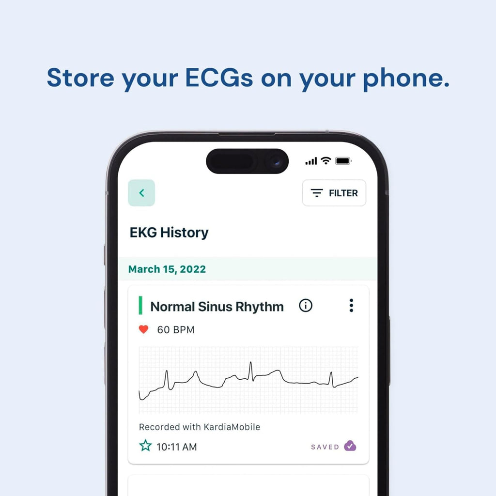 Kardiamobile 1-Lead Personal ECG Heart Rate Monitor - Record Ecgs at Home, Detects Atrial Fibrillation, Trusted by the NHS, Results in 30 Seconds, Works with Most Smartphones