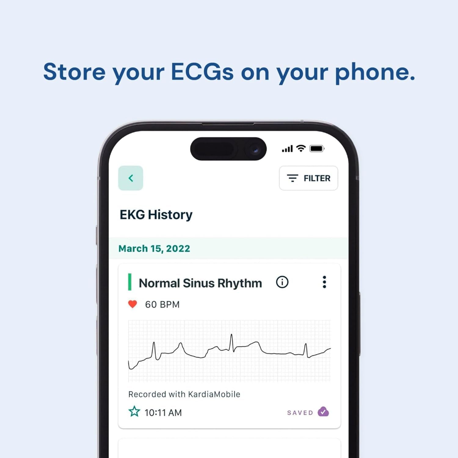 Kardiamobile 1-Lead Personal ECG Heart Rate Monitor - Record Ecgs at Home, Detects Atrial Fibrillation, Trusted by the NHS, Results in 30 Seconds, Works with Most Smartphones