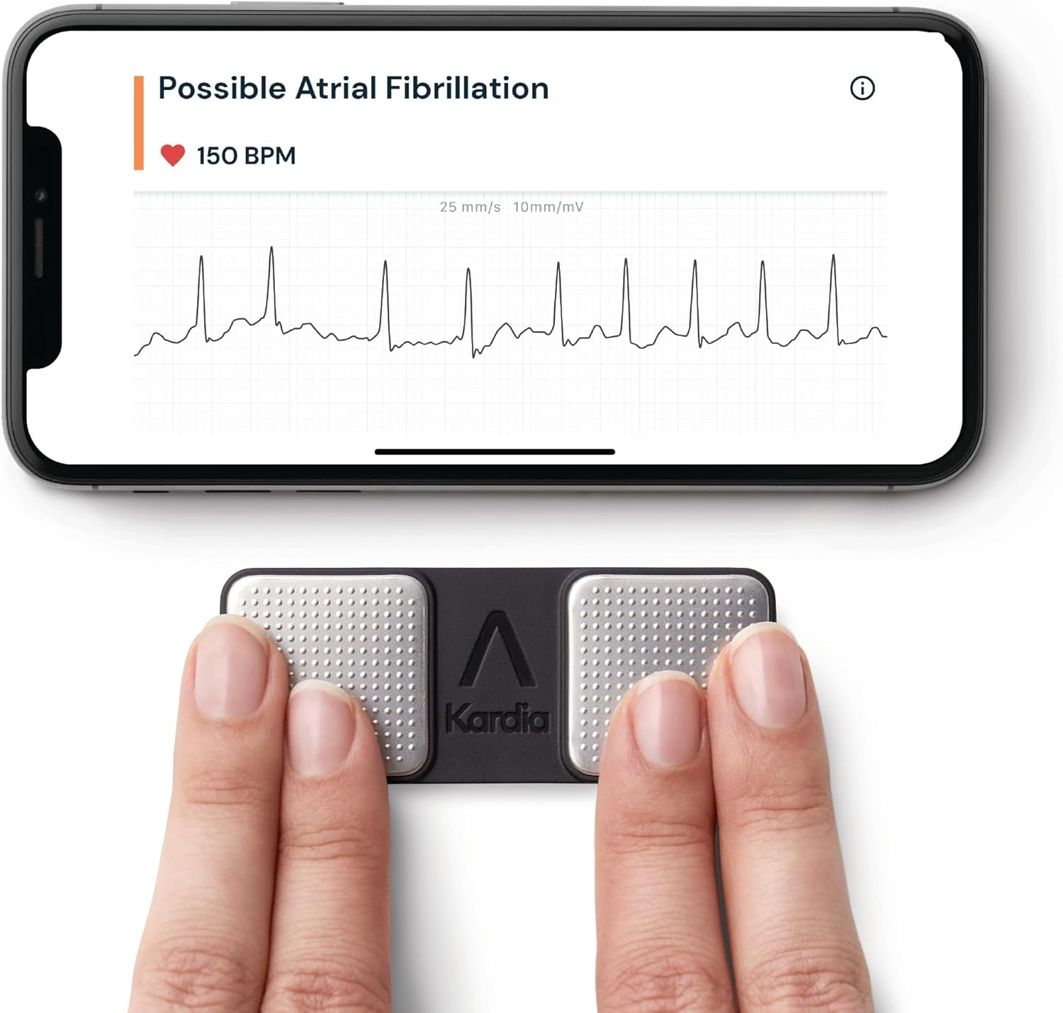 Kardiamobile 1-Lead Personal ECG Heart Rate Monitor - Record Ecgs at Home, Detects Atrial Fibrillation, Trusted by the NHS, Results in 30 Seconds, Works with Most Smartphones